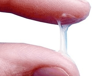 What does a man's secretion normally look like